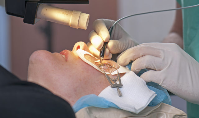 Josef Bille – der Vater der Lasik